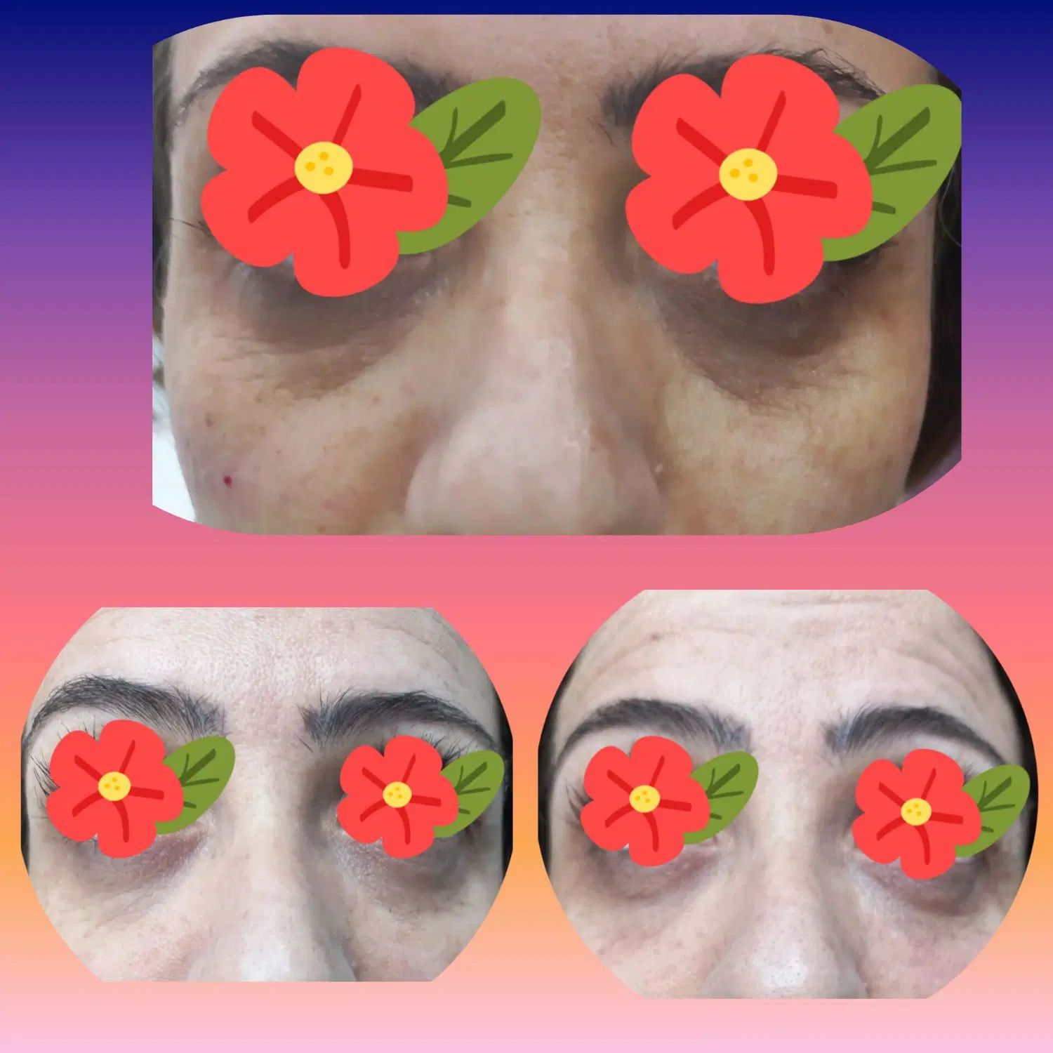 تخفیف بوتاکس، ژل، مزوژل، پی آر پی توسط پزشک|خدمات آرایشگری و زیبایی|مشهد, گوهرشاد|دیوار