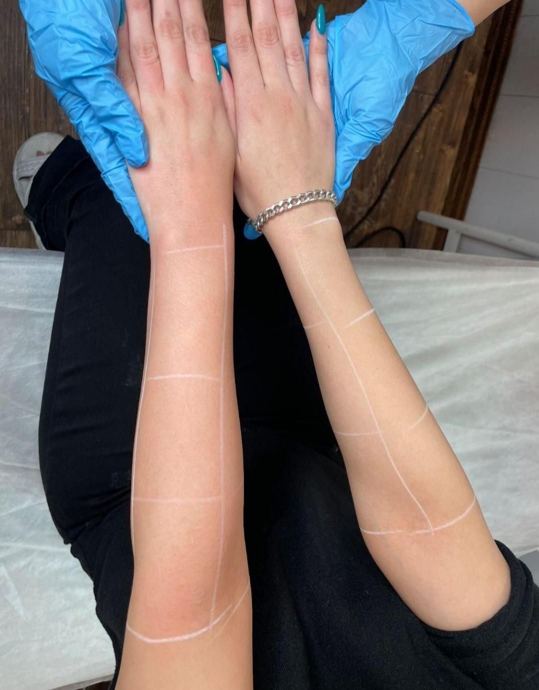 لیزر موهای زائد میکروسویچ و اپلومد کندلا وایتنینگ|خدمات آرایشگری و زیبایی|اصفهان, طامه|دیوار