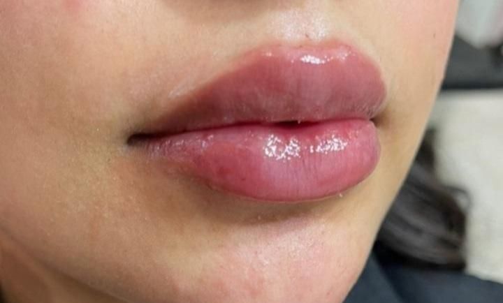 انجام خدمات ژل و بوتاکس|خدمات آرایشگری و زیبایی|اسلامشهر, شهرک مصطفی خمینی|دیوار