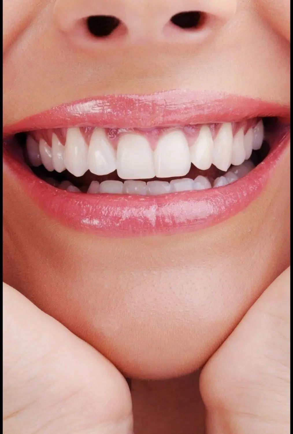 جشنواره تابستانی درمانگاه دندانپزشکی سرو|خدمات آرایشگری و زیبایی|مرند, |دیوار