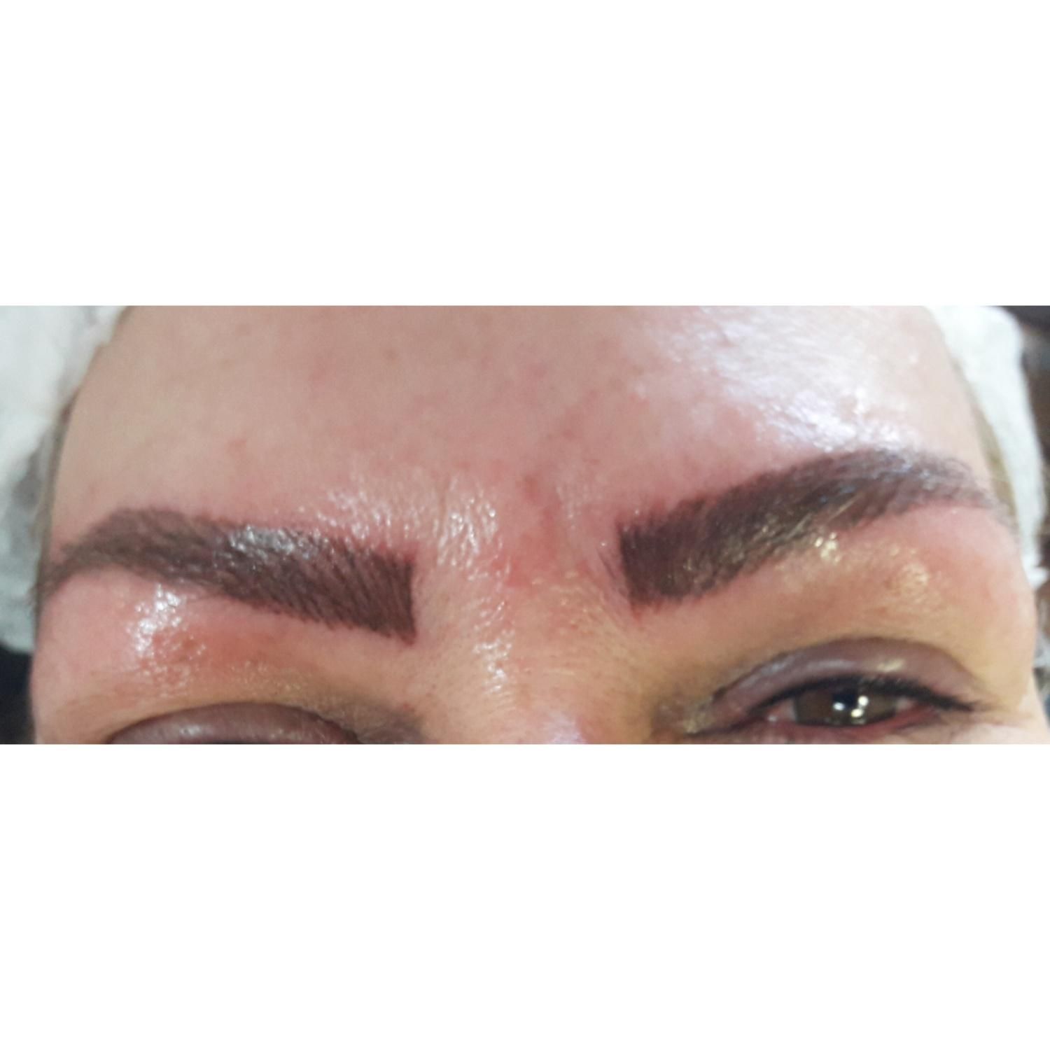 جشنواره یلداتخفیف،میکروپیکمنتیشن وریمووال،۴۰٪|خدمات آرایشگری و زیبایی|سبزوار, فرهنگیان|دیوار