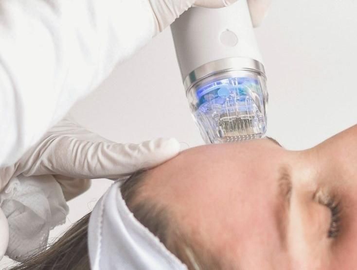 جوانسازی و لایه برداری پوست توسط پزشک|خدمات آرایشگری و زیبایی|زنجان, |دیوار