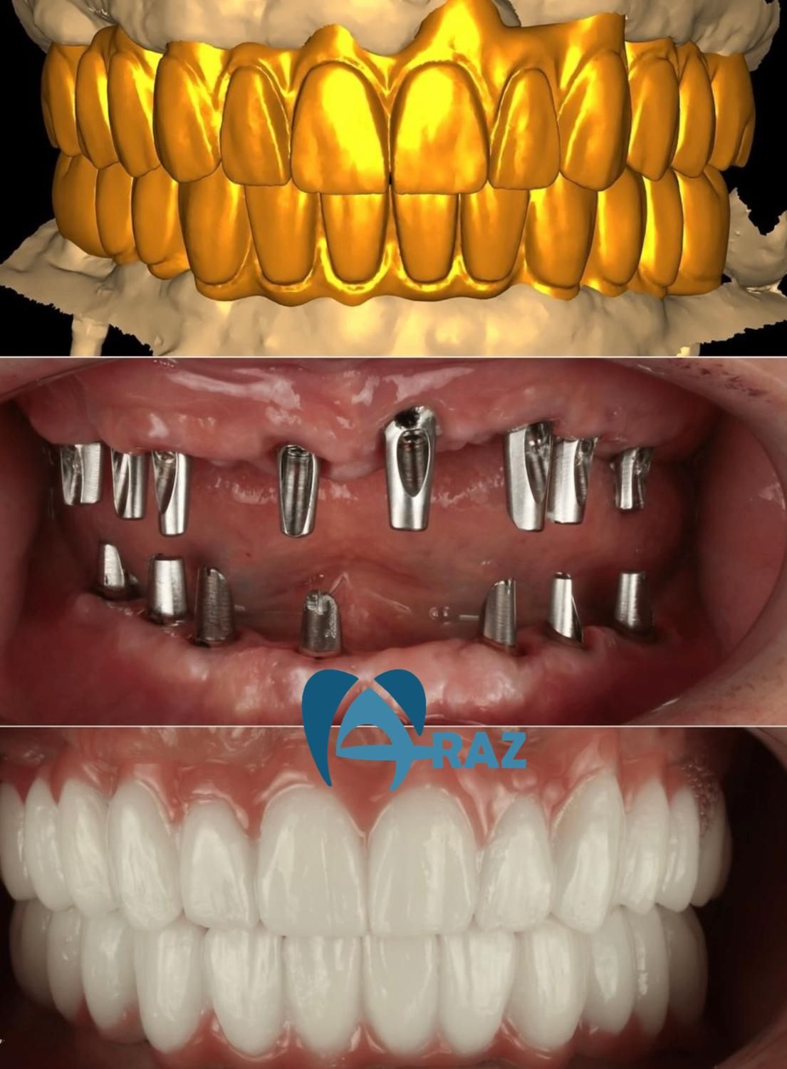 کلینیک تخصصی ایمپلنت دیجیتال/دندانپزشکی کاشت دندان|خدمات آرایشگری و زیبایی|تهران, پاسداران|دیوار