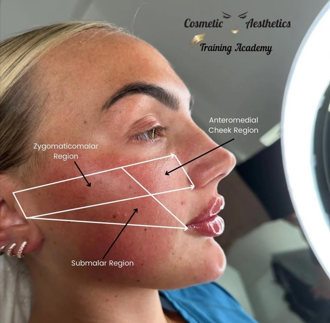 دوره آموزشی کامل بوتاکس/ژل/مزوتراپی/نخ/آنزیم|خدمات آموزشی|کرمانشاه, |دیوار