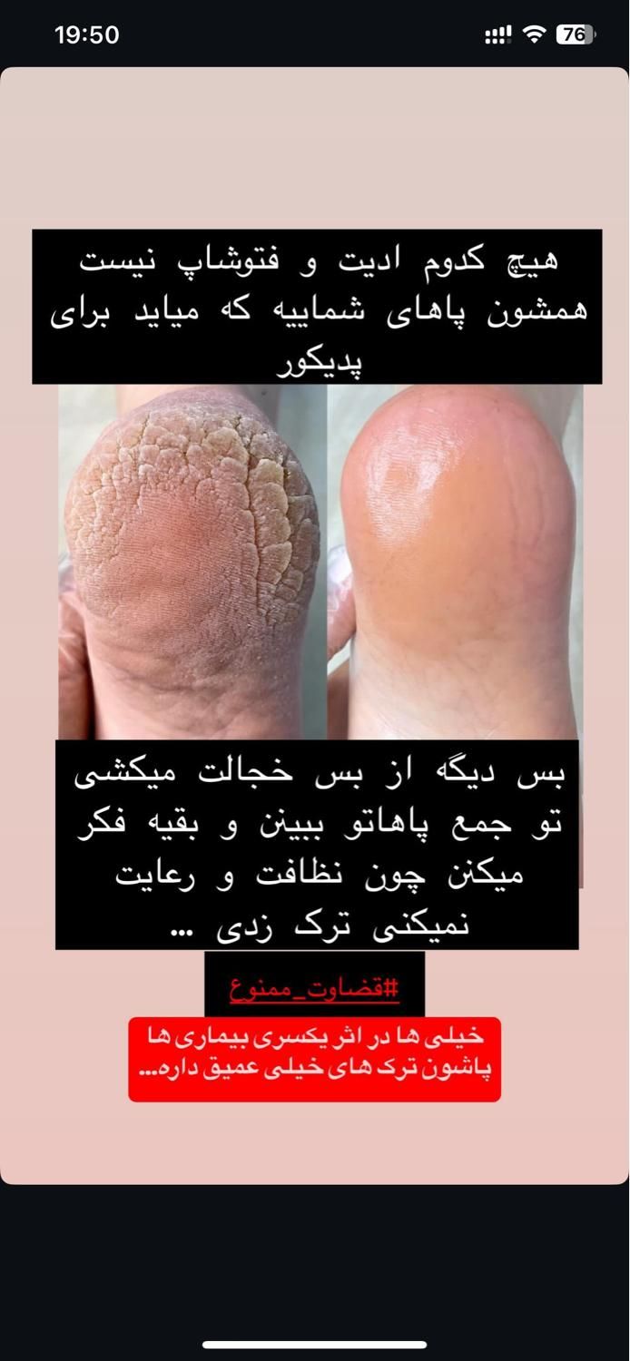 خدمات پودولوژی و پدیکور درمانی ، تخلیه میخچه و ..|خدمات آرایشگری و زیبایی|تهران, فردوس|دیوار