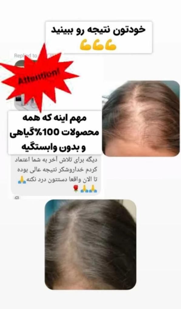 نمایندگی تونیک هیرفرند اصل (باریزش مو خداحافظی کن)|آرایشی، بهداشتی، درمانی|تهران, پونک|دیوار