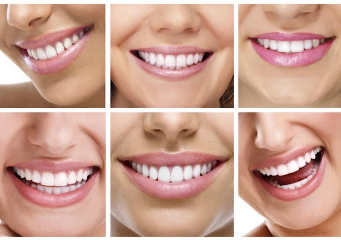 فرصت ویژه انجام کامپوزیت ونیر|خدمات آرایشگری و زیبایی|اصفهان, دوطفلان|دیوار