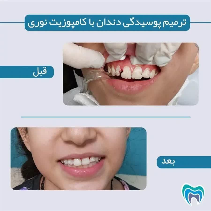 درمانگاه دندانپزشکی مهرشفا با شرایط اقساط|خدمات آرایشگری و زیبایی|قم, حنیف نژاد|دیوار