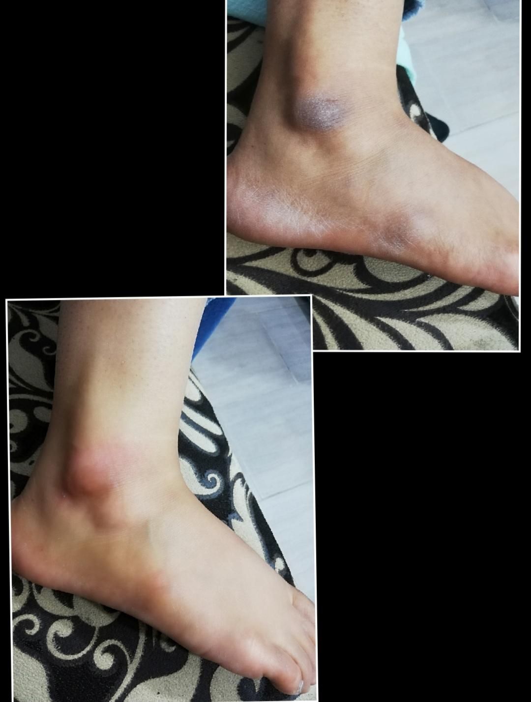 ازبین بردن تیرگی ،ازبین بردن ترک عمیق پا|خدمات آرایشگری و زیبایی|بوشهر, |دیوار