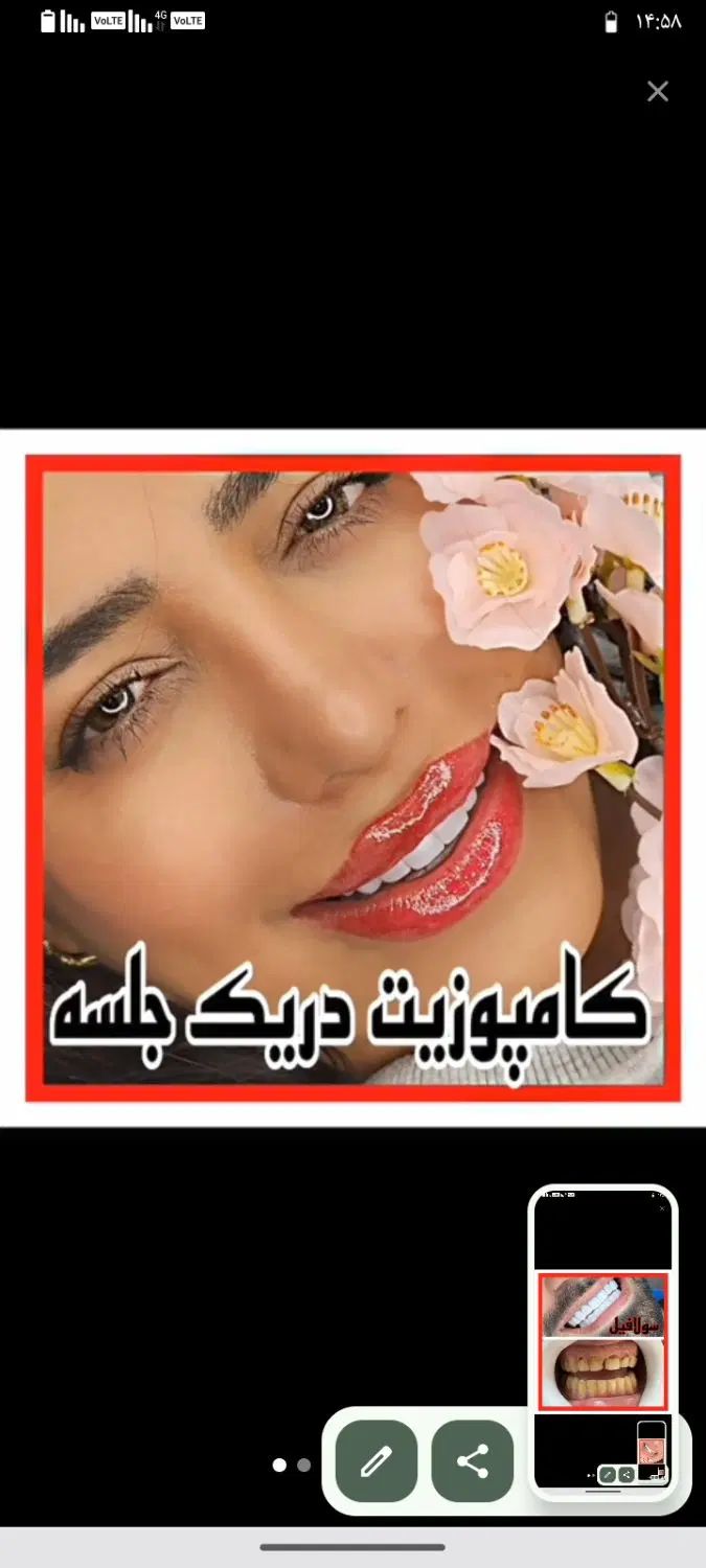 دندان پزشکی دندان مصنوعی|خدمات آرایشگری و زیبایی|تهران, عباس‌آباد|دیوار