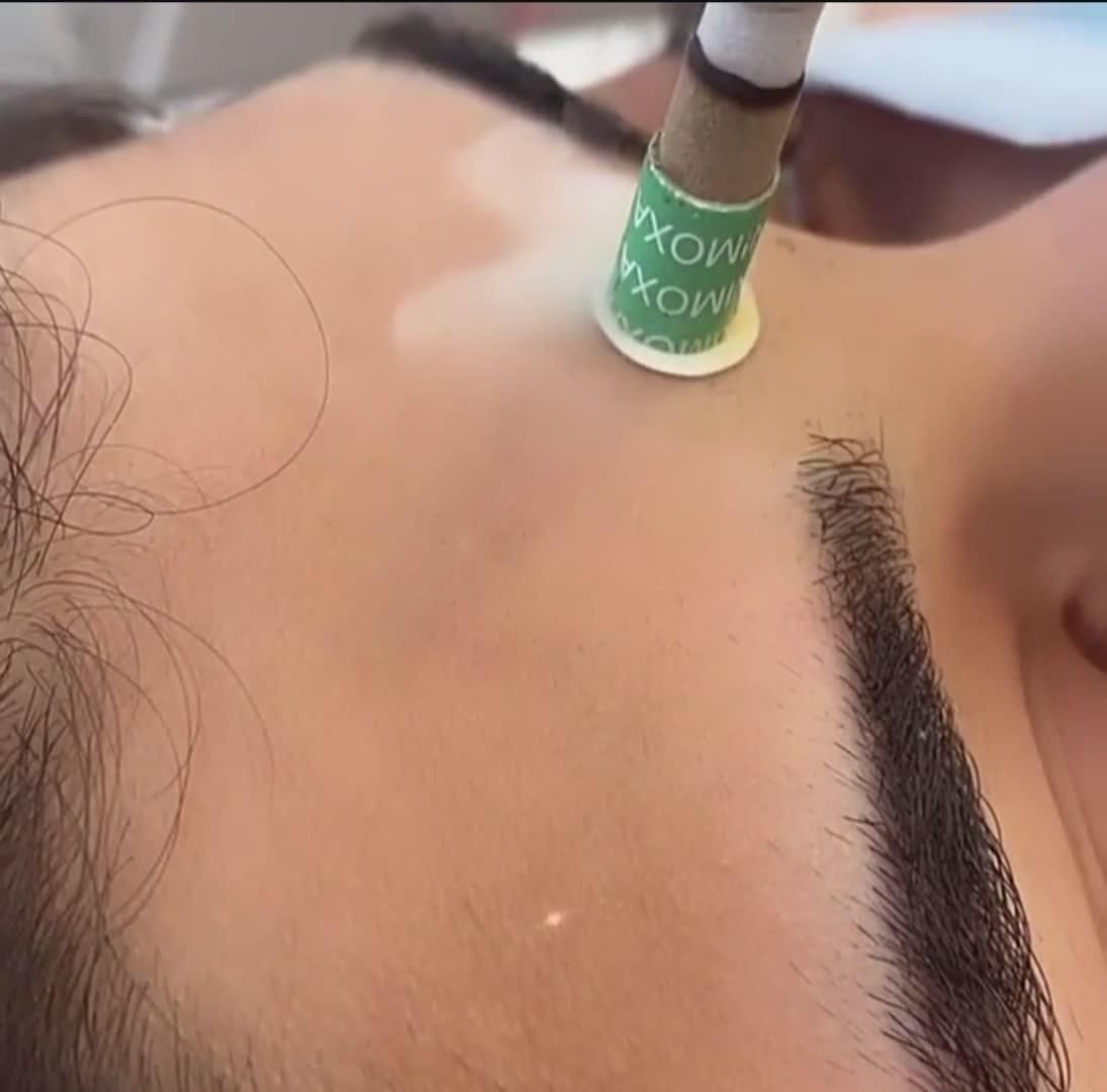 پی آر پی حجامت امبدینگ طب سوزنی زالو بادکش|خدمات آرایشگری و زیبایی|اصفهان, فروردین|دیوار