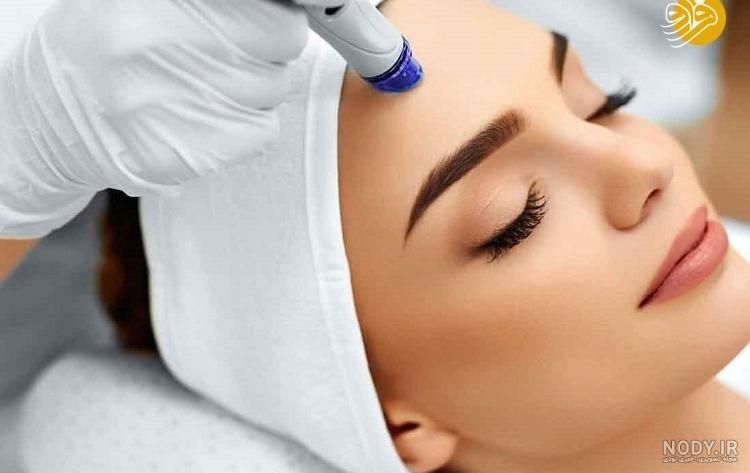 کربن تراپی لیزر کیوسوئیچ بستن منافذ|خدمات آرایشگری و زیبایی|دهدشت, |دیوار