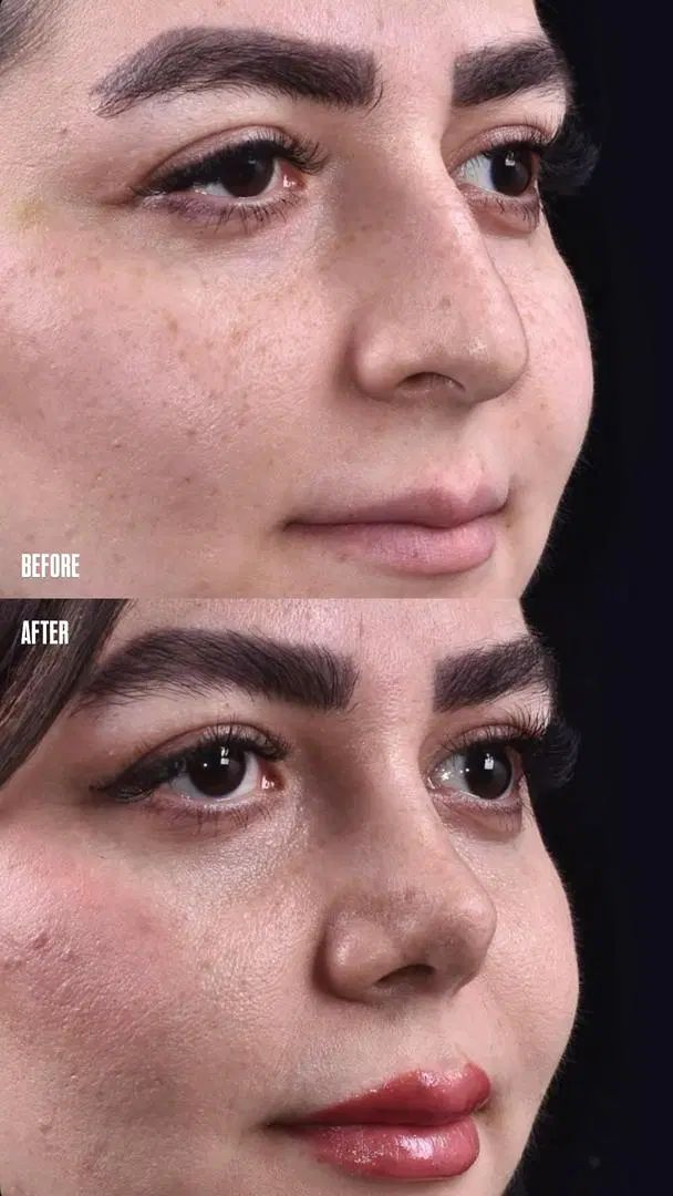 جراحی بدون نقص و متفاوت|خدمات آرایشگری و زیبایی|تهران, ازگل|دیوار