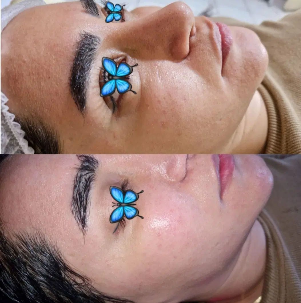 مژده مژده تخفیف فشیال و پاکسازی پوست فقط ۱۹۰تومن|خدمات آرایشگری و زیبایی|مشهد, طبرسی شمالی|دیوار