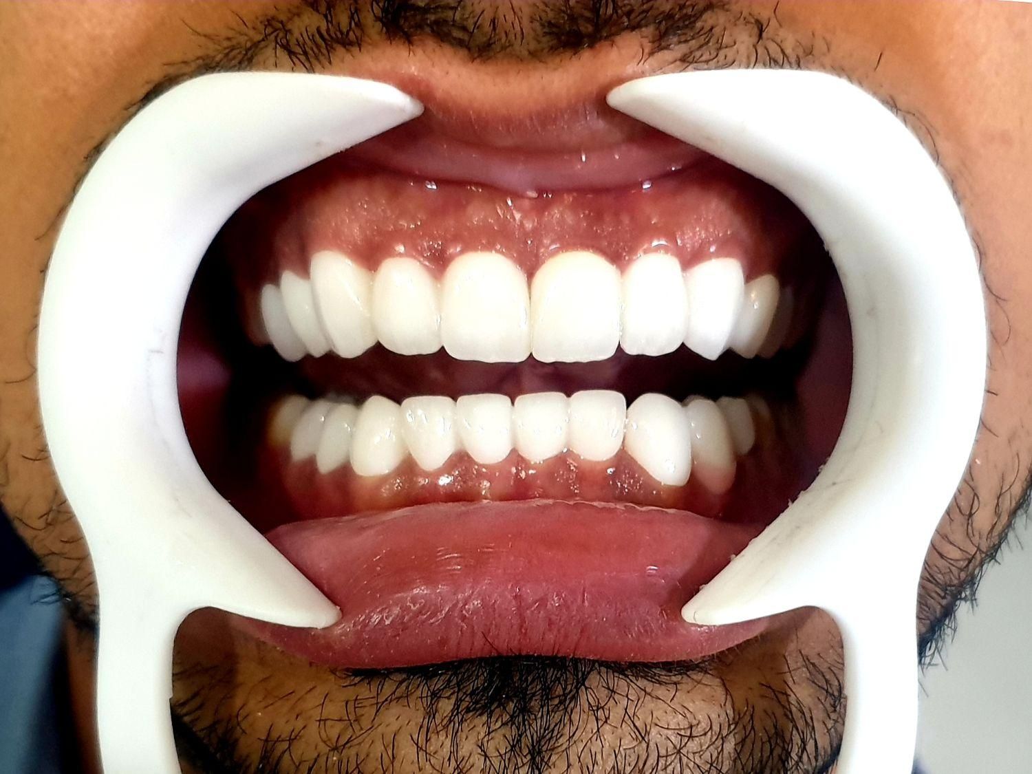 خدمات دندانپزشکی برلیان|خدمات آرایشگری و زیبایی|بانه, |دیوار