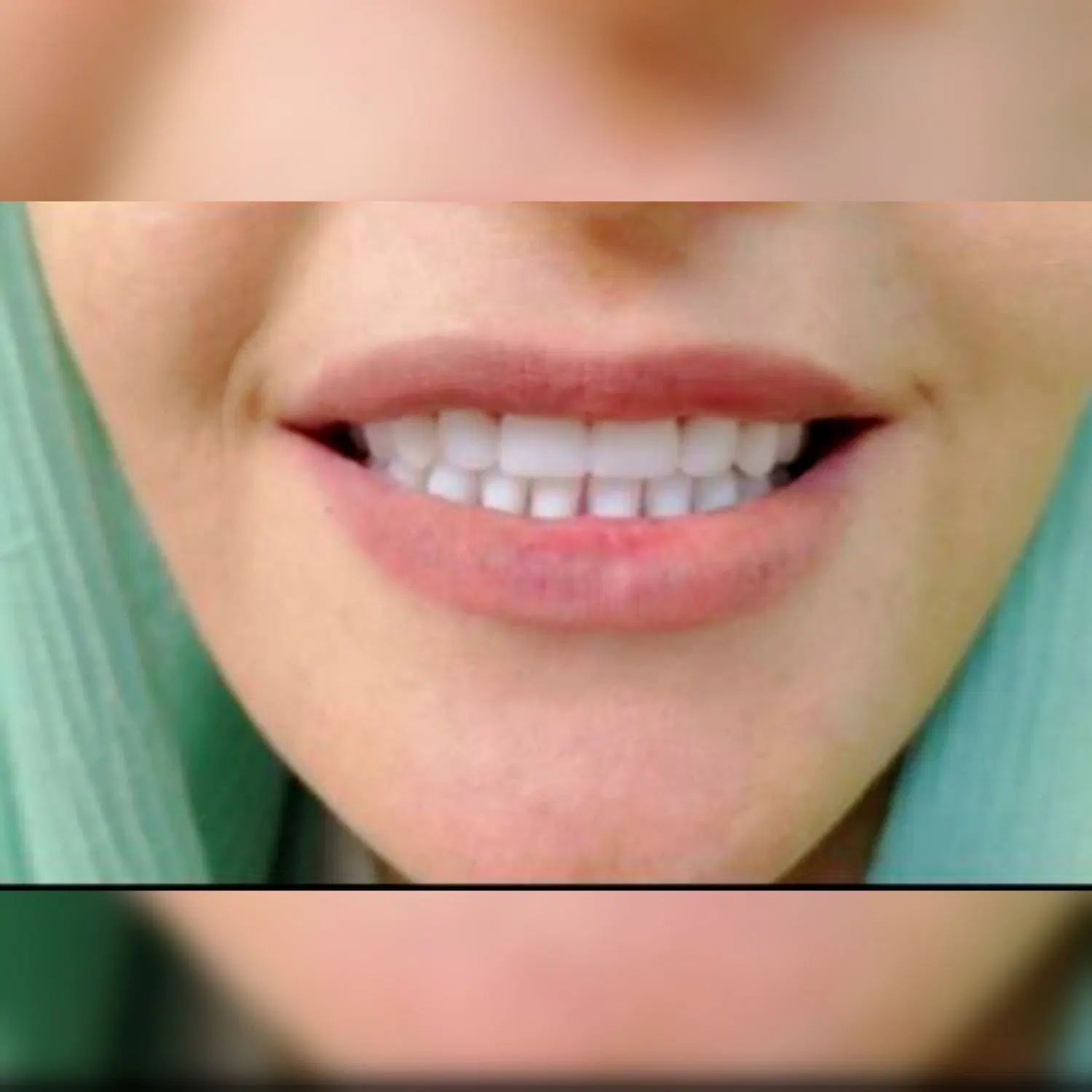دندانسازی دندانپزشکی ایمپلنت کامپوزیت پروتز ثابت|خدمات آرایشگری و زیبایی|مشهد, پنجتن|دیوار