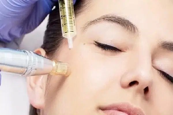 ورکشاپ تخصصی میکرونیدلینگ و BTL تراپی|خدمات آموزشی|کرج, احدآباد|دیوار