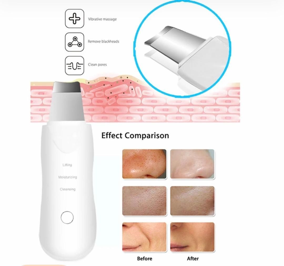 پوستی صاف و جوان با دستگاه اتو صورت التراسونیک|آرایشی، بهداشتی، درمانی|تهران, شهرک آپادانا|دیوار
