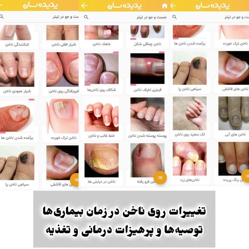 زالودرمانی تخصصی حجامت وبادکش|خدمات آرایشگری و زیبایی|مشهد, رضاییه|دیوار