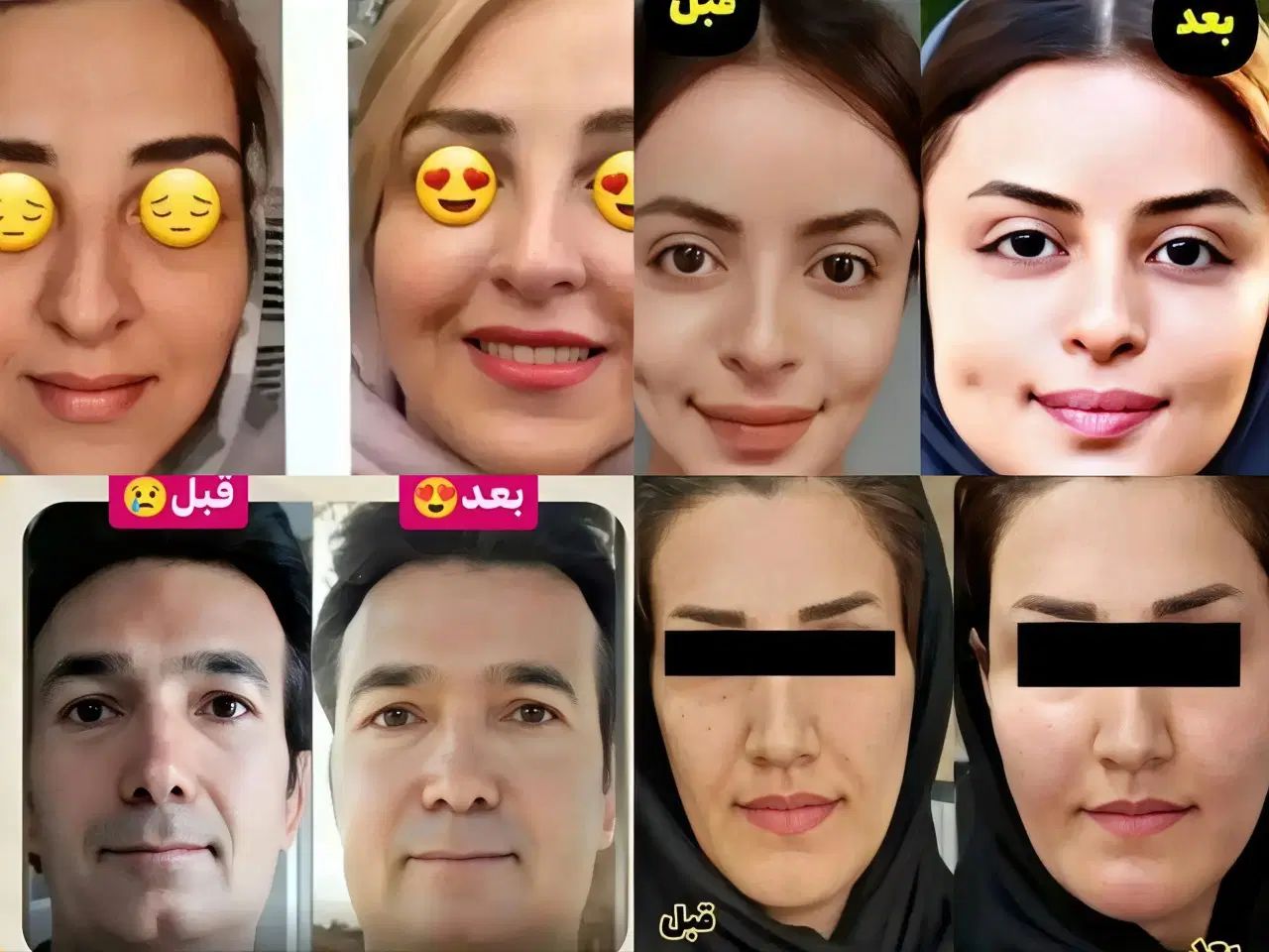 پرکننده طبیعی صورت|خوردنی و آشامیدنی|کرج, پیشاهنگی|دیوار