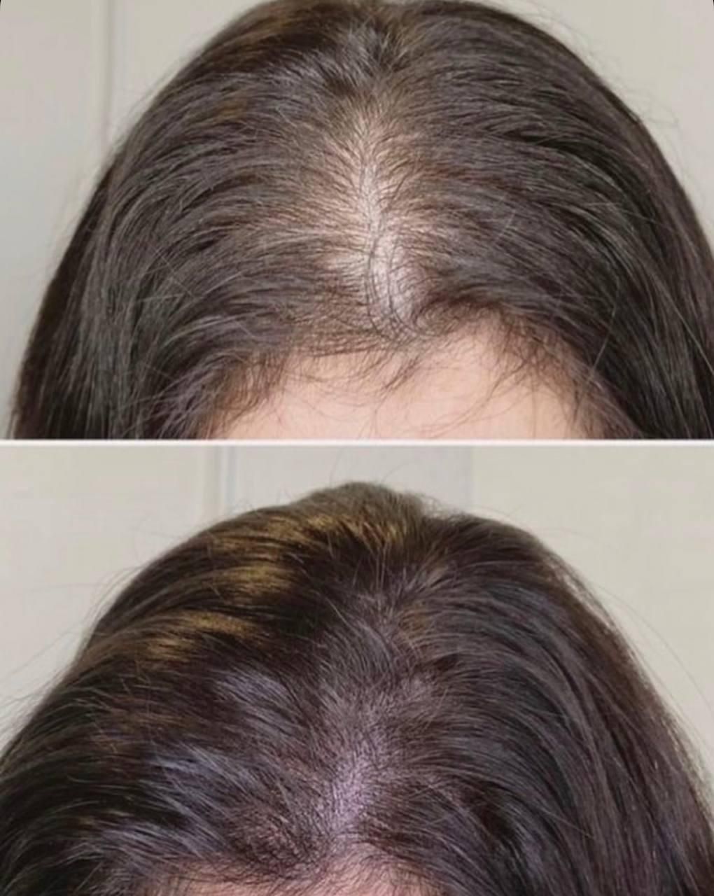 آفر20 درصد درمان قطعی ریزش مو و رویش بدون بازگشت|خدمات آرایشگری و زیبایی|مشهد, کوثر|دیوار