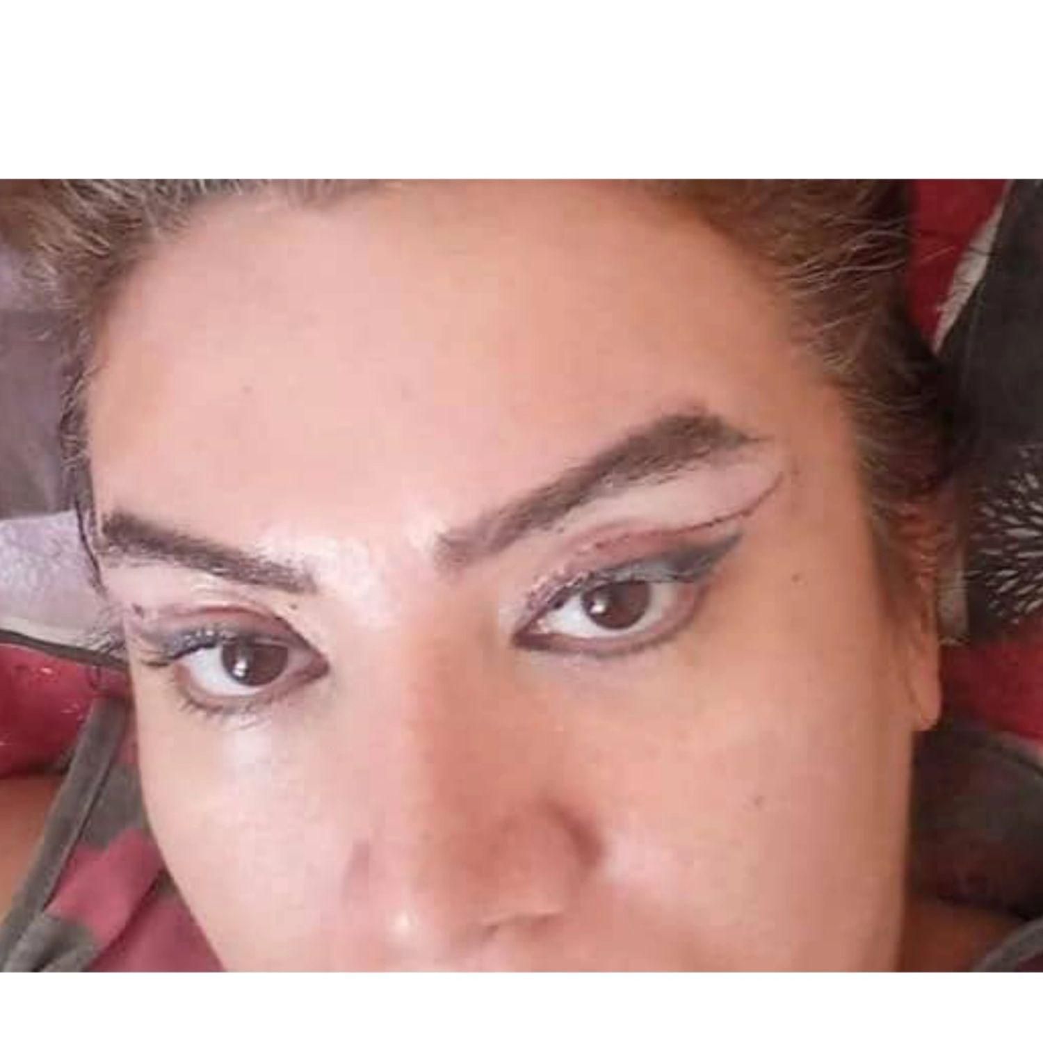 جراحی عمل پلک/بلفاروپلاستی/ساکشن غبغب/سانترال لب|خدمات آرایشگری و زیبایی|کرج, عظیمیه|دیوار