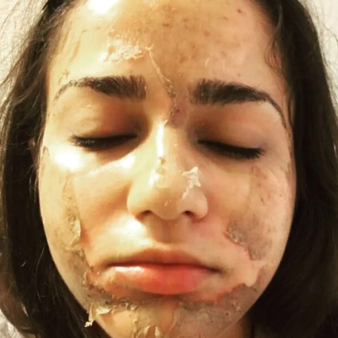 آموزش تکنیک پوست ماری|خدمات آموزشی|تهران, امیریه|دیوار