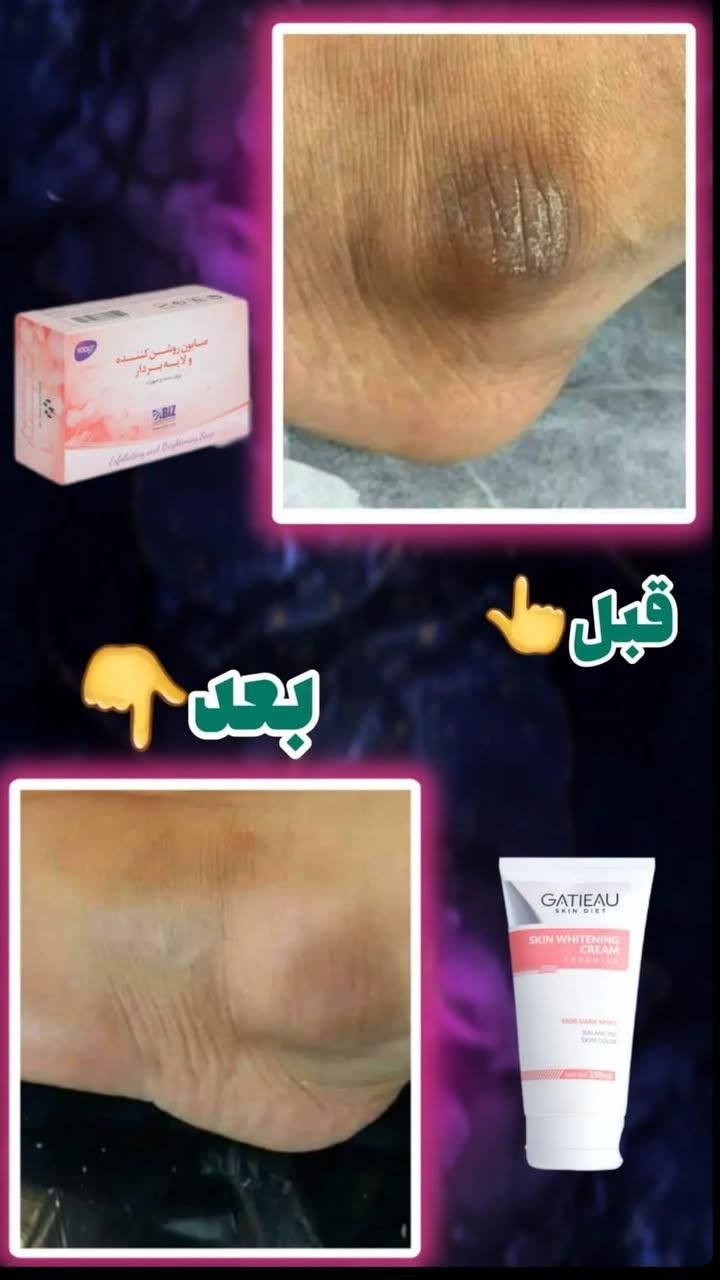 کرم روشن کننده گاتیو اورجینال اصل  برند گاتیو|آرایشی، بهداشتی، درمانی|پاکدشت, پاکدشت (مامازند)|دیوار