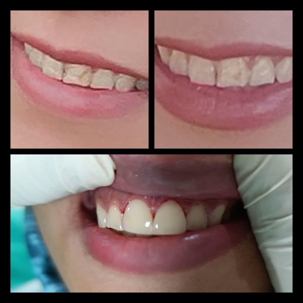 دندانپزشکی،ایمپلنت،ارتودنسی لمینت وکامپوزیت اقساطی|خدمات آرایشگری و زیبایی|نجف‌آباد, شریعتی غربی|دیوار