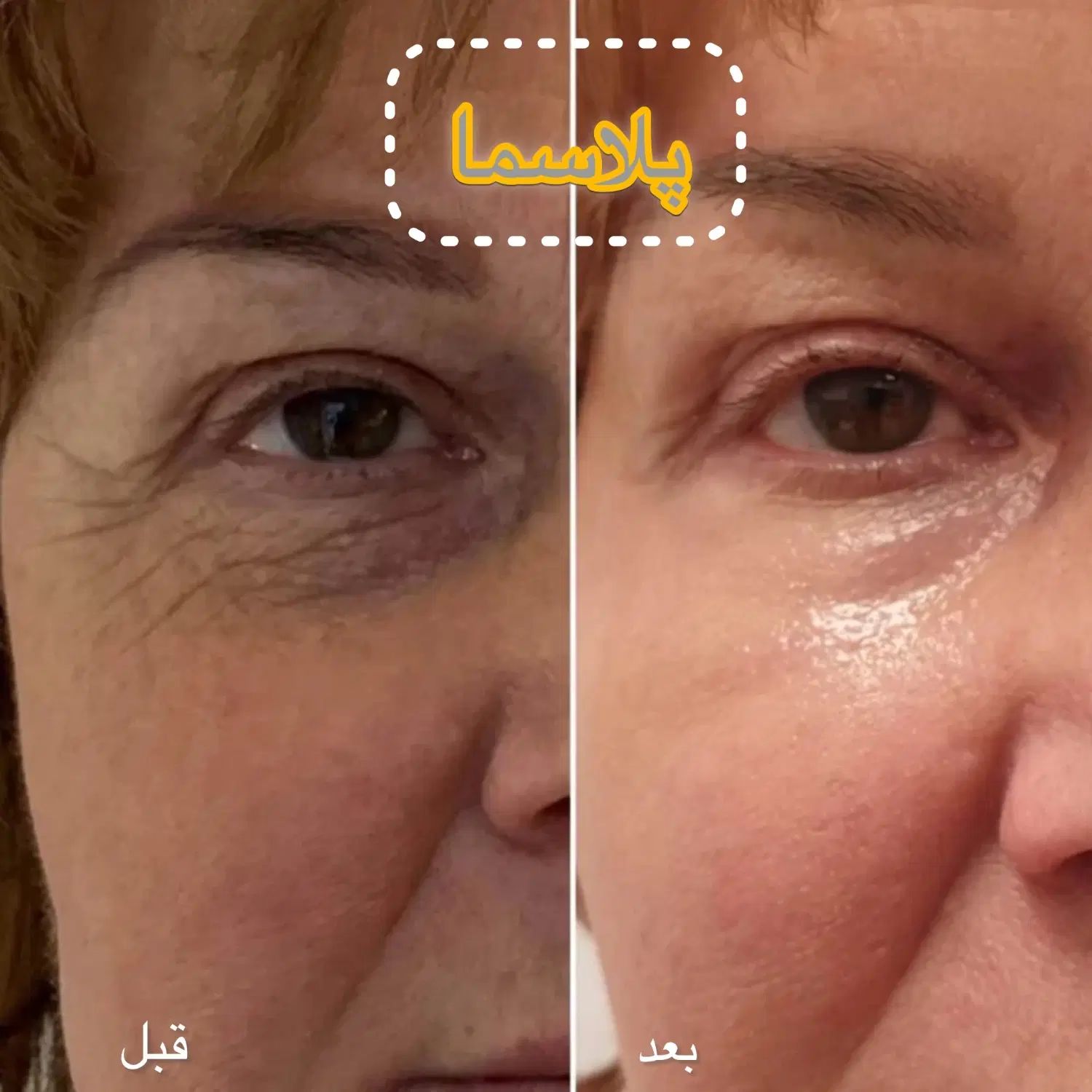 جشنواره خدمات تخصصی لیزر و فیشیال،برداشتن خال و لک|خدمات آرایشگری و زیبایی|کرج, مهرویلا جنوبی|دیوار