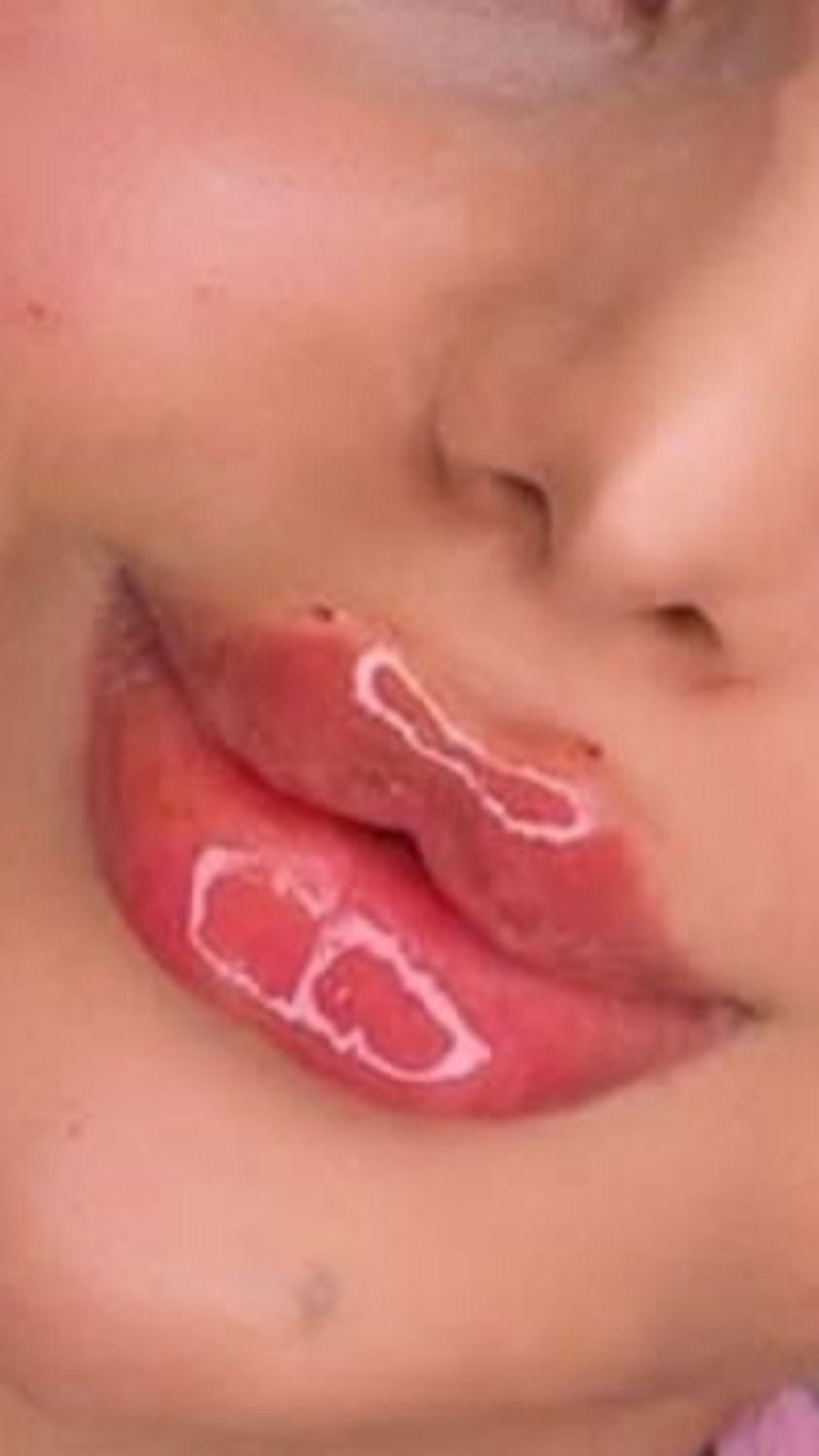 ژل بوتاکس ۳۹۰/ فیلربینی زیرچشم/لیفت صورت شقیقه/نخ|خدمات آرایشگری و زیبایی|تهران, فدک|دیوار