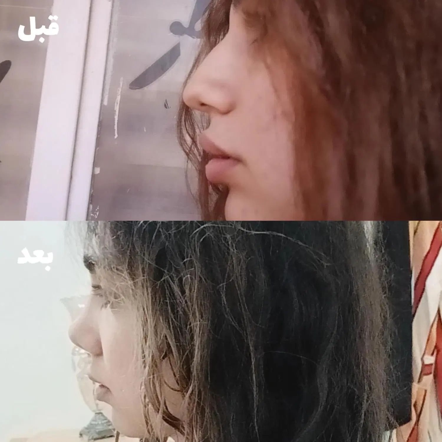 ظرفیت خالی عمل بینی  با ۲۲میلیون با متخصص بینی|خدمات آرایشگری و زیبایی|تهران, جمال‌زاده|دیوار