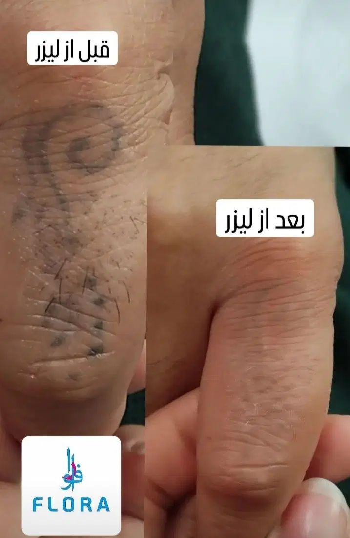 جلسه اول رایگان به مناسبت سالگرد افتتاحیه|خدمات آرایشگری و زیبایی|تبریز, |دیوار