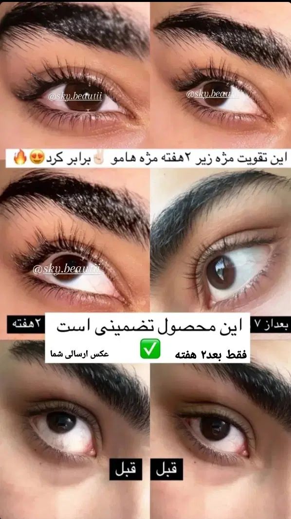ریمل تقویت مژه و ابرو لاکچری کویین / فرانسوی اصل|آرایشی، بهداشتی، درمانی|تهران, قیطریه|دیوار
