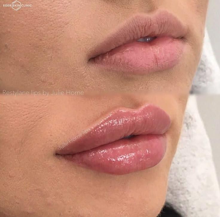 تخفیف ویژه ژل و بوتاکس شیدینگ لب و بن مژه و پرسینگ|خدمات آرایشگری و زیبایی|مشهد, توس (بلوار توس)|دیوار