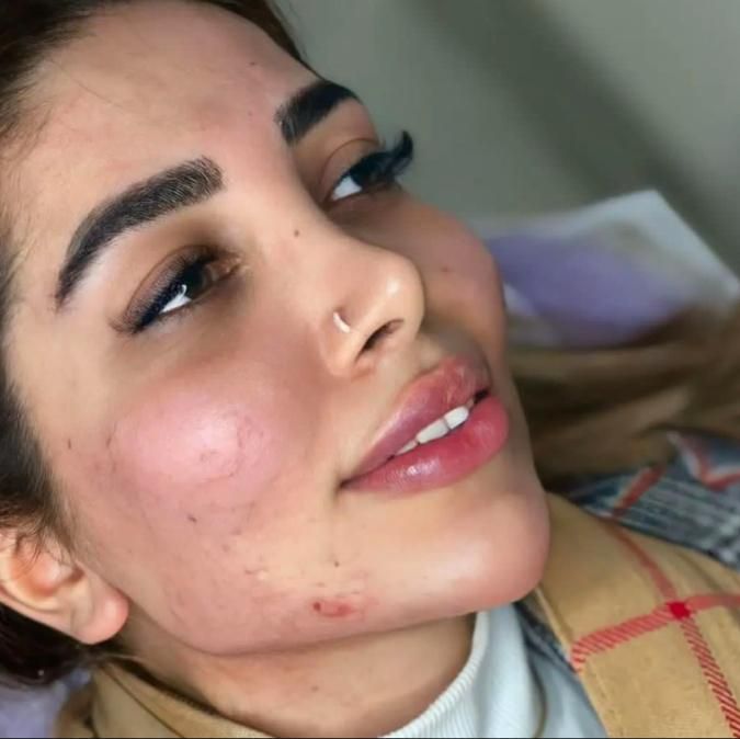 کلینیک ژل لب روسی و بوتاکس و آنزیم فیلر مطب پزشک|خدمات آرایشگری و زیبایی|کرج, گوهردشت|دیوار