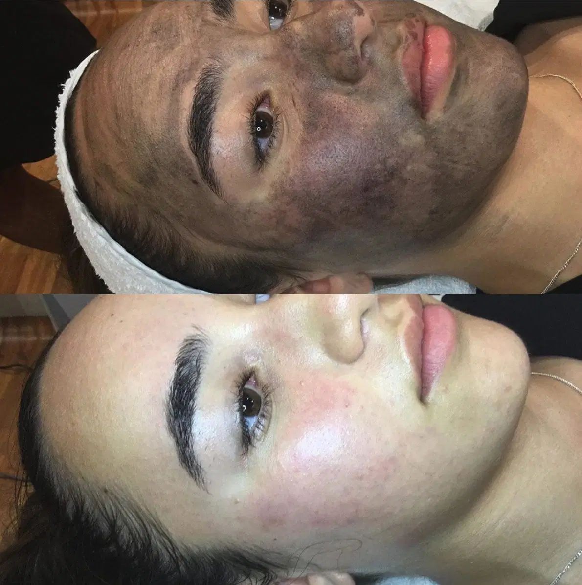 کربن تراپی ،پیلینگ هالیوودی،ریمو تتو صورت و بدن|خدمات آرایشگری و زیبایی|شیراز, فرهنگ شهر|دیوار