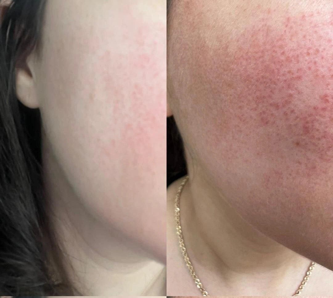 پاکسازی پوست فروش محصولات آرایشی و بهداشتی صورت...|خدمات آرایشگری و زیبایی|گلبهار, |دیوار