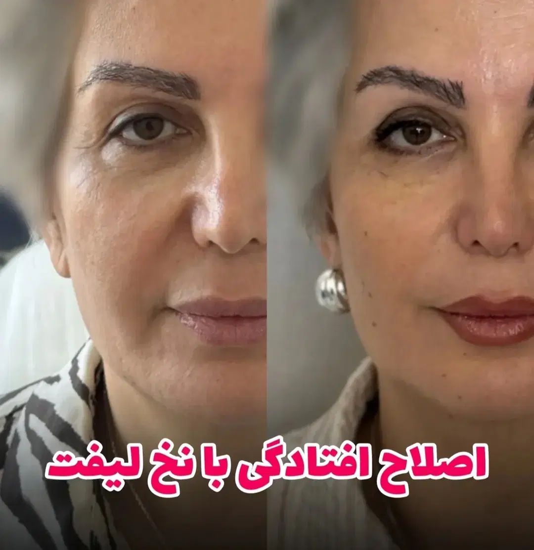 مدل خدمات زیبایی پزشکی در درمانگاه جهت تکمیل پیج|خدمات آرایشگری و زیبایی|اهواز, پادادشهر|دیوار
