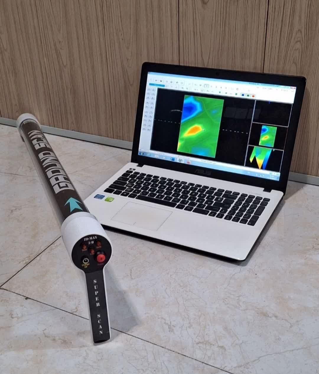 اسکنر سه بعدی تصویری برای تشخیص حفره|پرینتر، اسکنر، کپی، فکس|تهران, شهرک غرب|دیوار