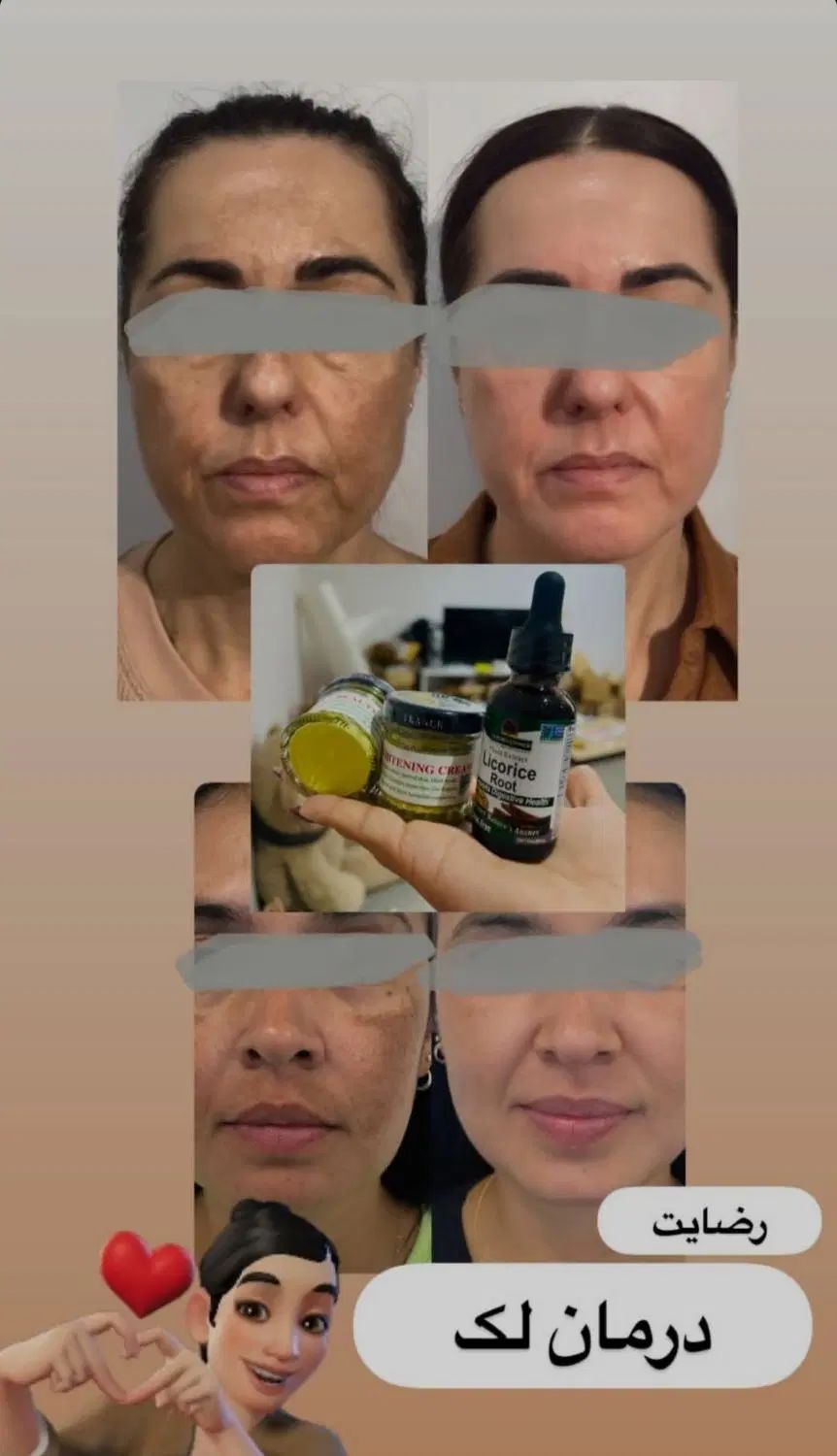 کرم دالفورداصل فرانسه ضدلک قوی بارداری وسفیدی پوست|آرایشی، بهداشتی، درمانی|تهران, اتحاد|دیوار