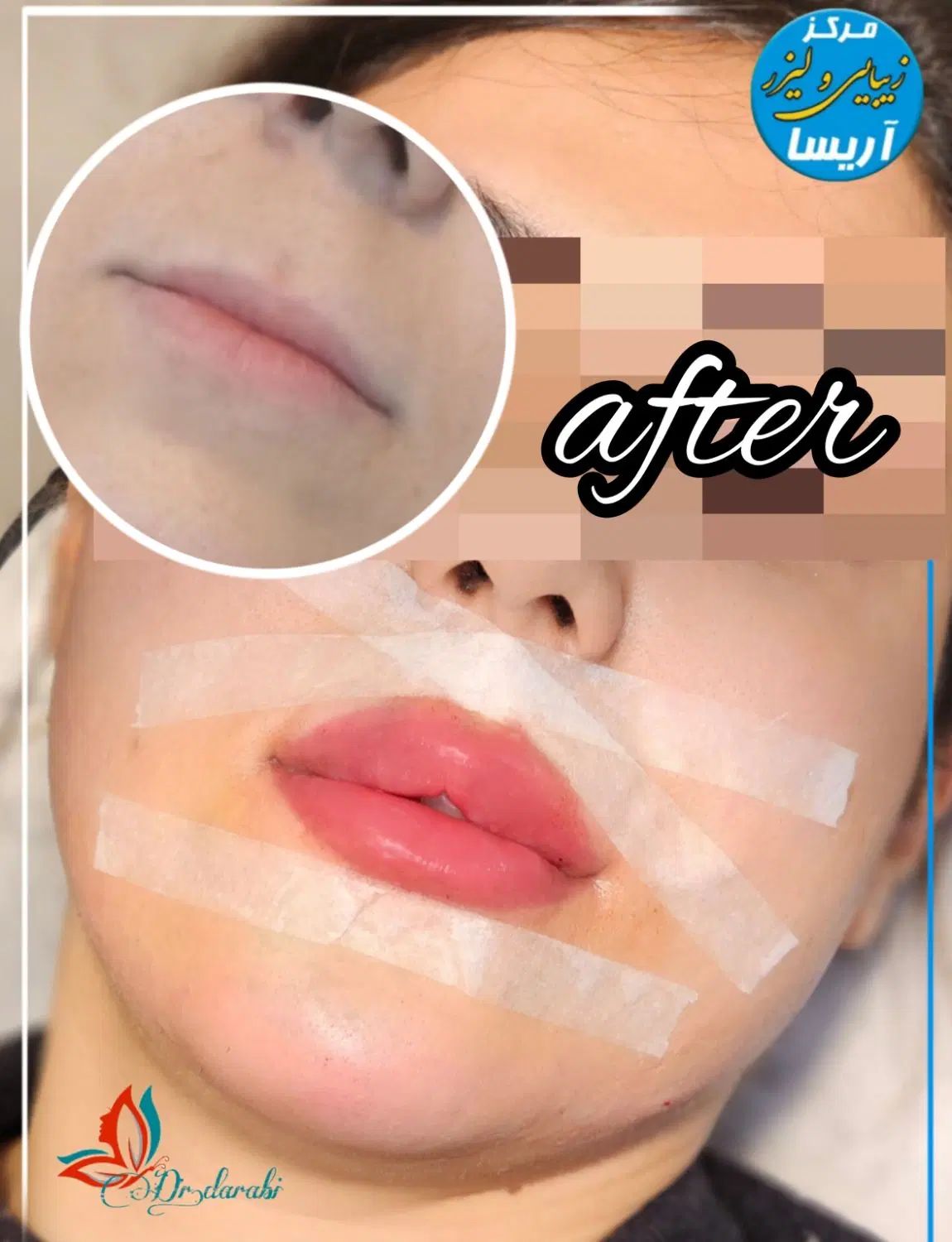 تخفیف ویژه خدمات پوست و مو به مناسبت روز  پزشک|خدمات آرایشگری و زیبایی|کرمانشاه, |دیوار