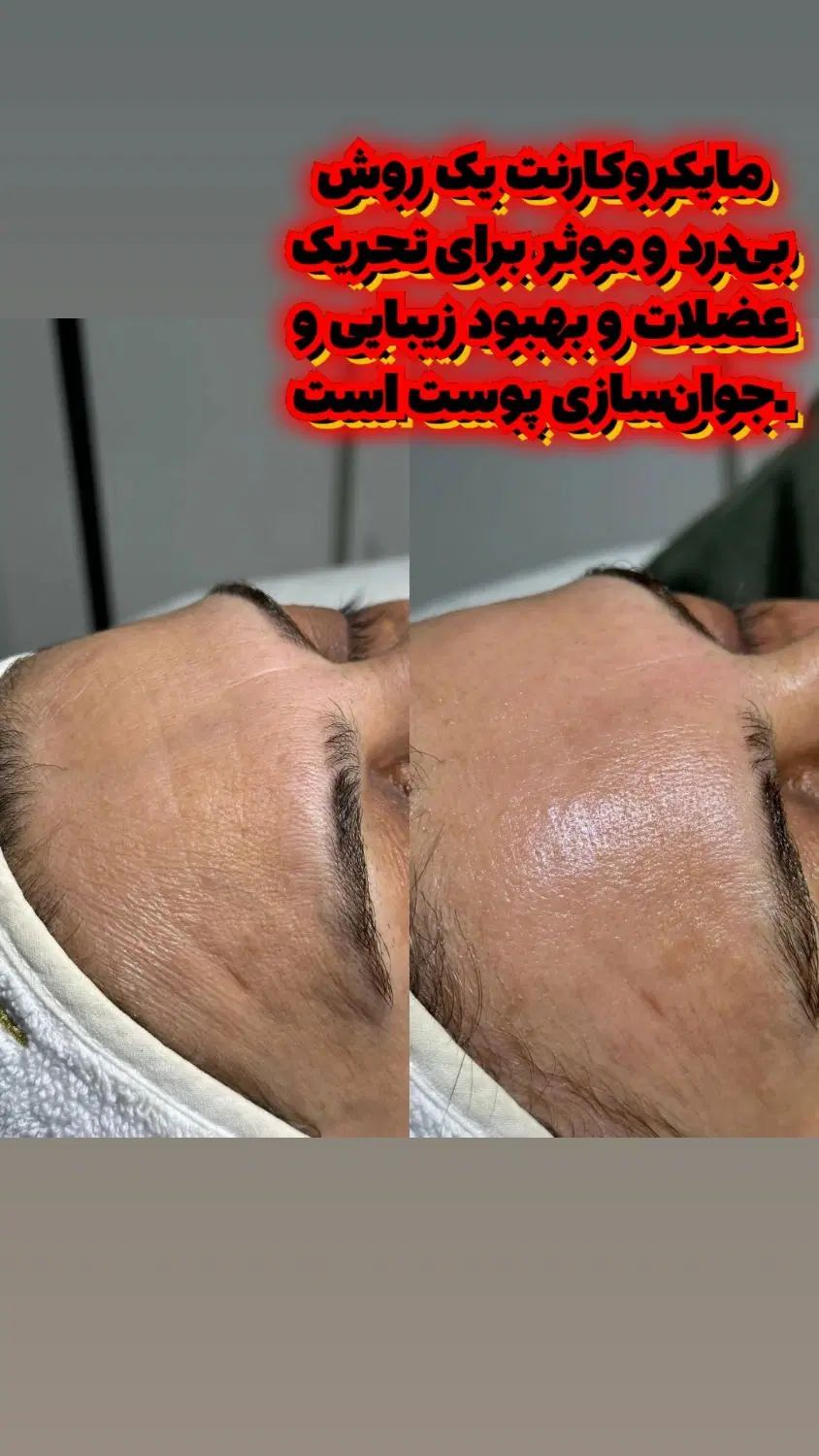 آموزش فشیال،مراقبت از پوست و تجهیزات پوست|خدمات آموزشی|نجف‌آباد, شریعتی|دیوار