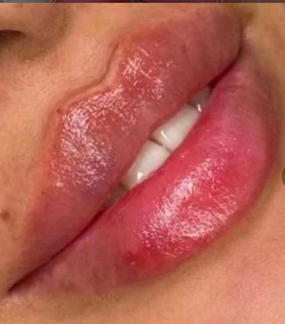 خدمات ژل و بوتاکس ، مزوتراپی سر و صورت|خدمات آرایشگری و زیبایی|شاهینشهر, فردوسی|دیوار