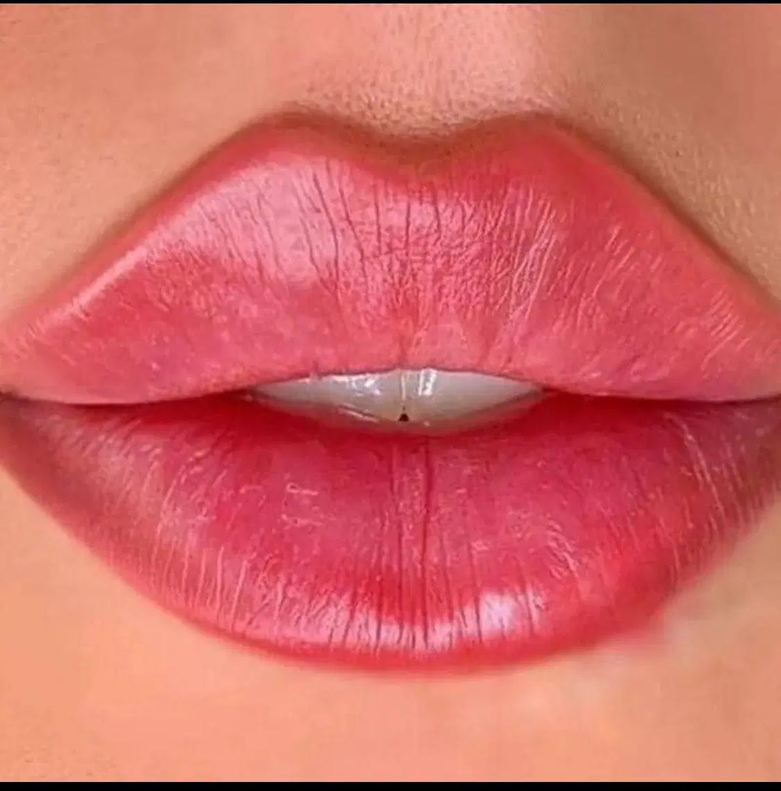 بمب تخفیف ویژه خدمات ژل / بوتاکس / جوانسازی|خدمات آرایشگری و زیبایی|شاهین‌شهر, فردوسی|دیوار