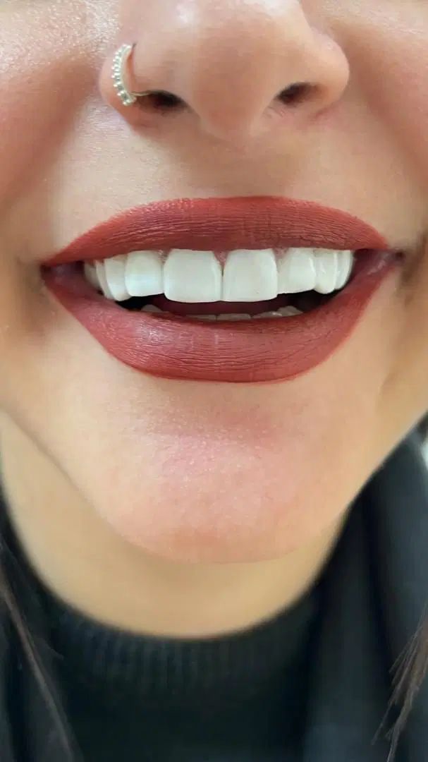 دندانپزشکی اطفال و بزرگسال|خدمات آرایشگری و زیبایی|رشت, پل تالشان|دیوار