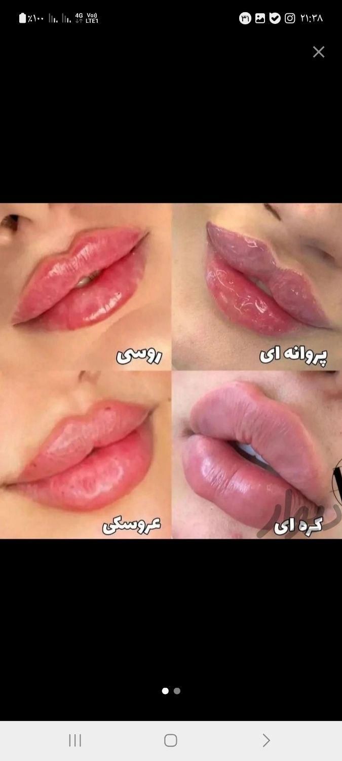 تخصص ما لیزر ژل و بوتاکس حرفه ای و جوانسازی پوست|خدمات آرایشگری و زیبایی|تهران, شهرک ولیعصر جنوبی|دیوار