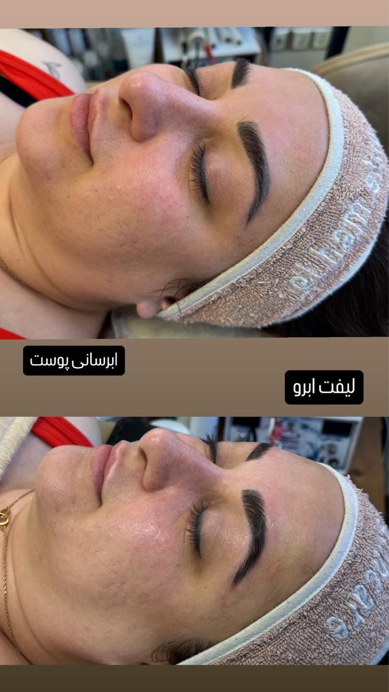 جشنواره تخفیف پاکسازی و فیشال، اکستنشن، لیفت|خدمات آرایشگری و زیبایی|تهران, قبا|دیوار