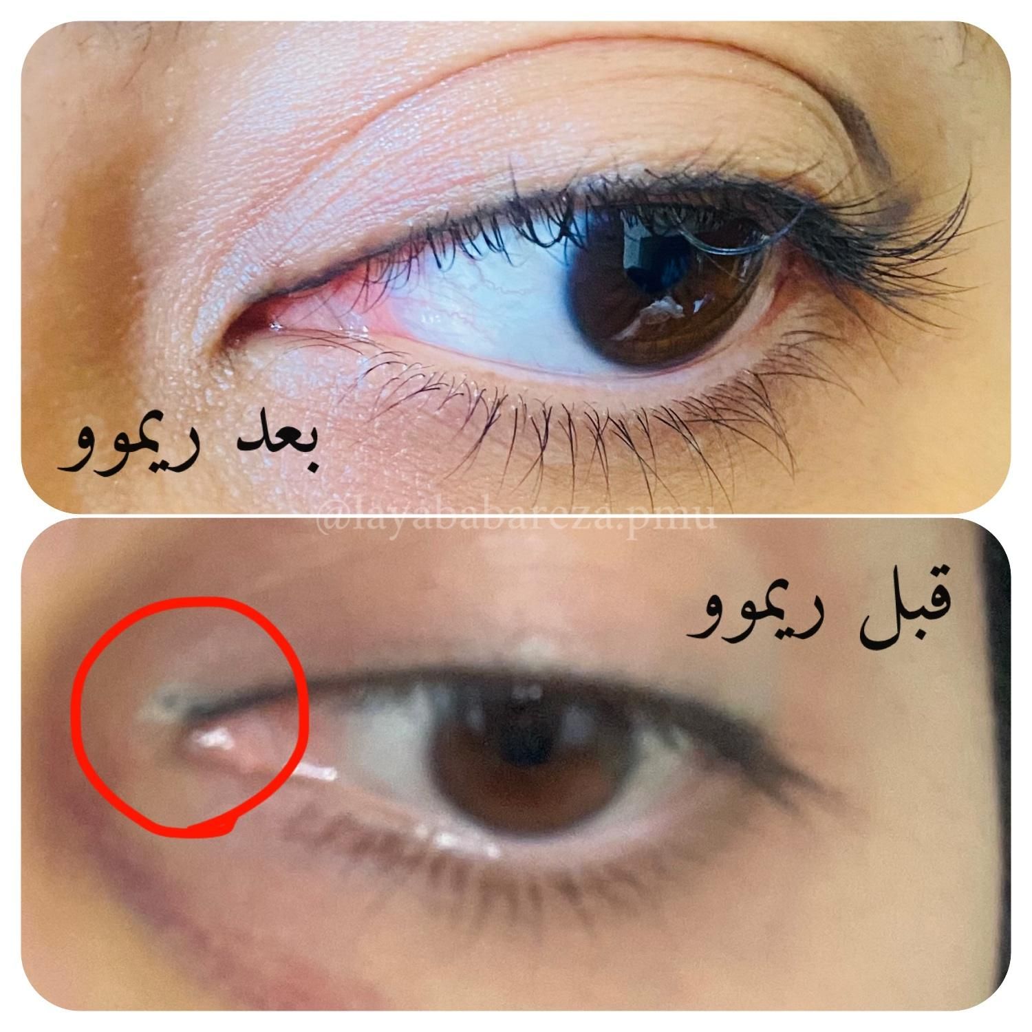 تتو،ریموو،شیدینگ لب با بهترین مواد و ماندگاری بالا|خدمات آرایشگری و زیبایی|مشهد, ولیعصر (شهرک غرب)|دیوار