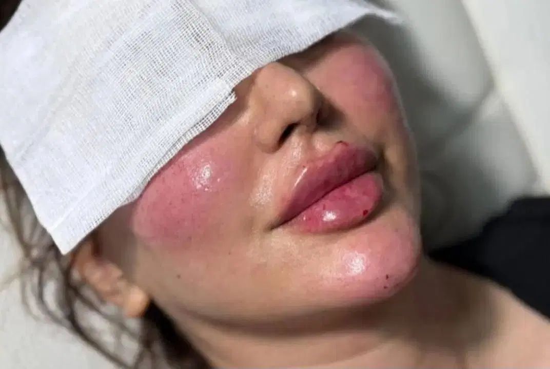 جشنواره تابستانه تزریق فیلروبوتاکس درکلینیک زیبایی|خدمات آرایشگری و زیبایی|اصفهان, وحید|دیوار
